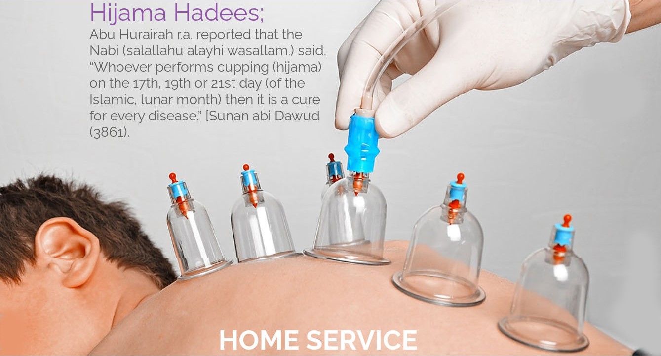 Hijama therapy display